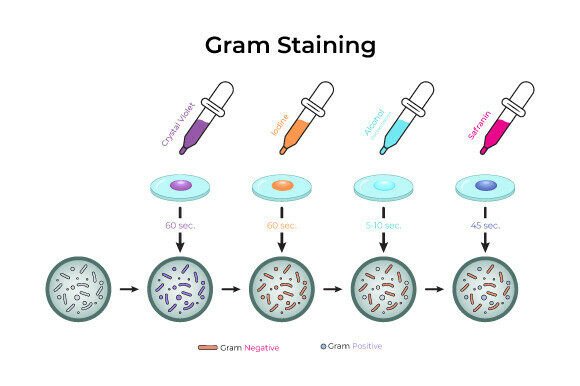 Download Gram Staining Process Diagram Design - Premium Bundle